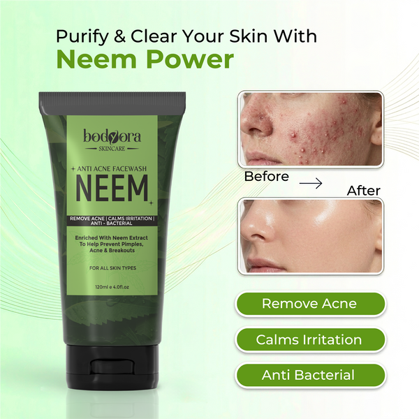 Neem Anti Acne Face Wash