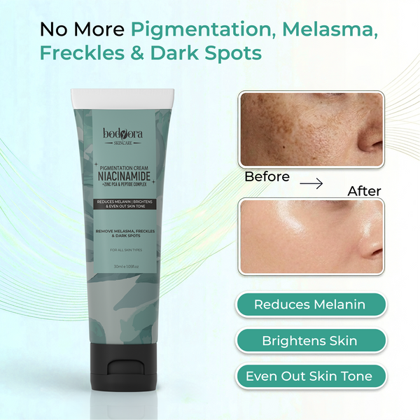 Niacinamide Pigmentation Cream