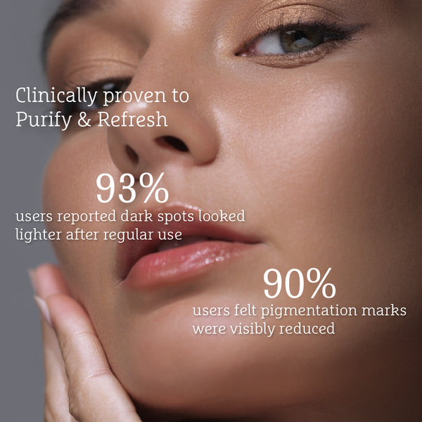 Niacinamide Pigmentation Cream