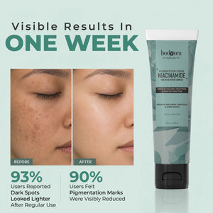 Niacinamide Pigmentation Cream