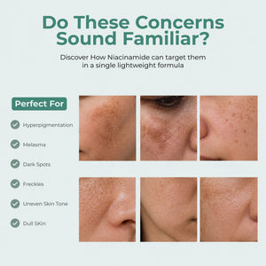 Niacinamide Pigmentation Cream