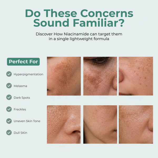 Niacinamide Pigmentation Cream