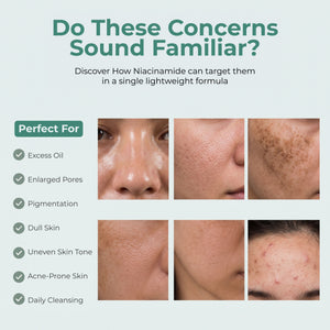 Niacinamide Pigmentation Cleansing Gel