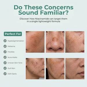 Niacinamide Pigmentation Serum