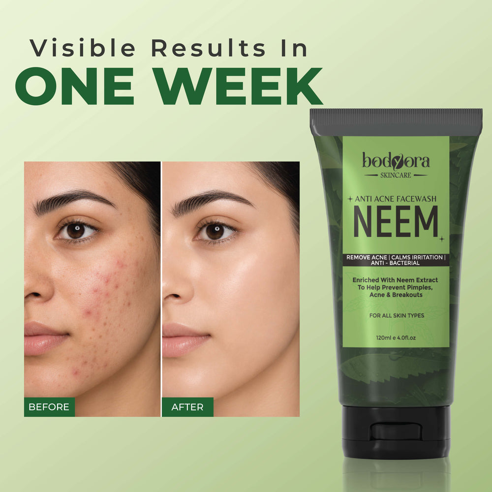 Neem Anti Acne Face Wash