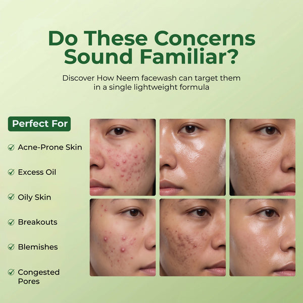 Neem Anti Acne Face Wash
